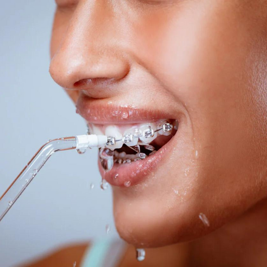 Oral Irrigator™ | Verbessern Sie Ihre Zahnpflege-Routine ganz einfach