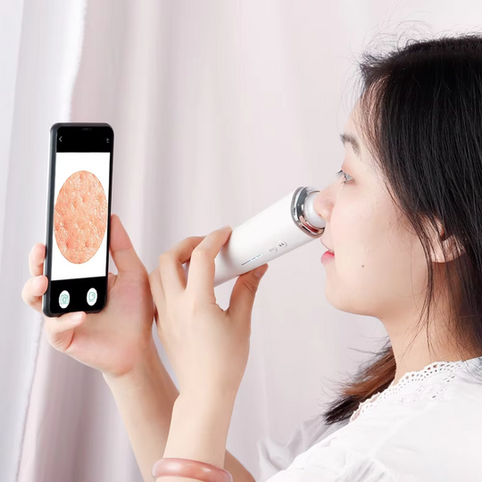 Pore Detox Pro | Mit Präzision Mitesser gezielt entfernen