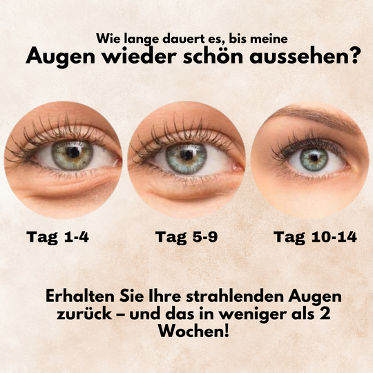 EyeGlow™ | Dunkle Augenringe sofort reduzieren