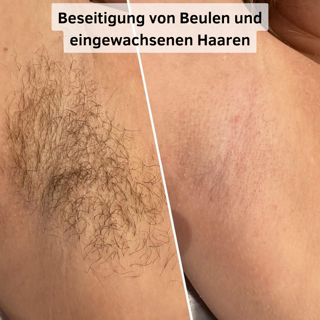 Beauty Gleit Pro™ | Glätte erzeugen!