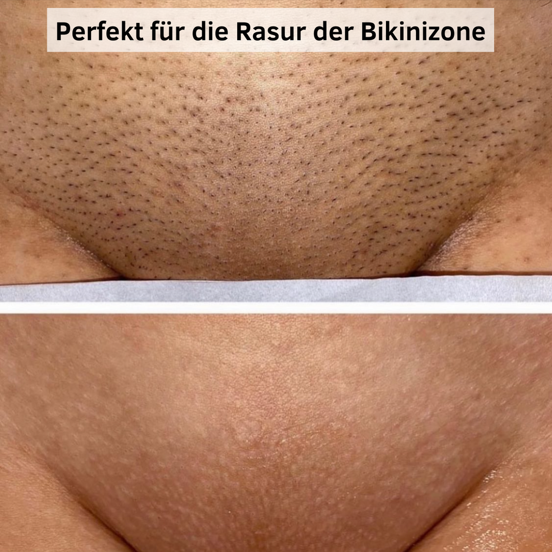 Beauty Gleit Pro™ | Glätte erzeugen!