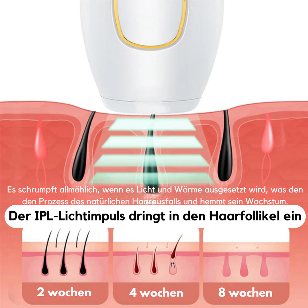 IPL Haarentfernungsgerät™ | Verabschieden Sie sich von unerwünschtem Haar